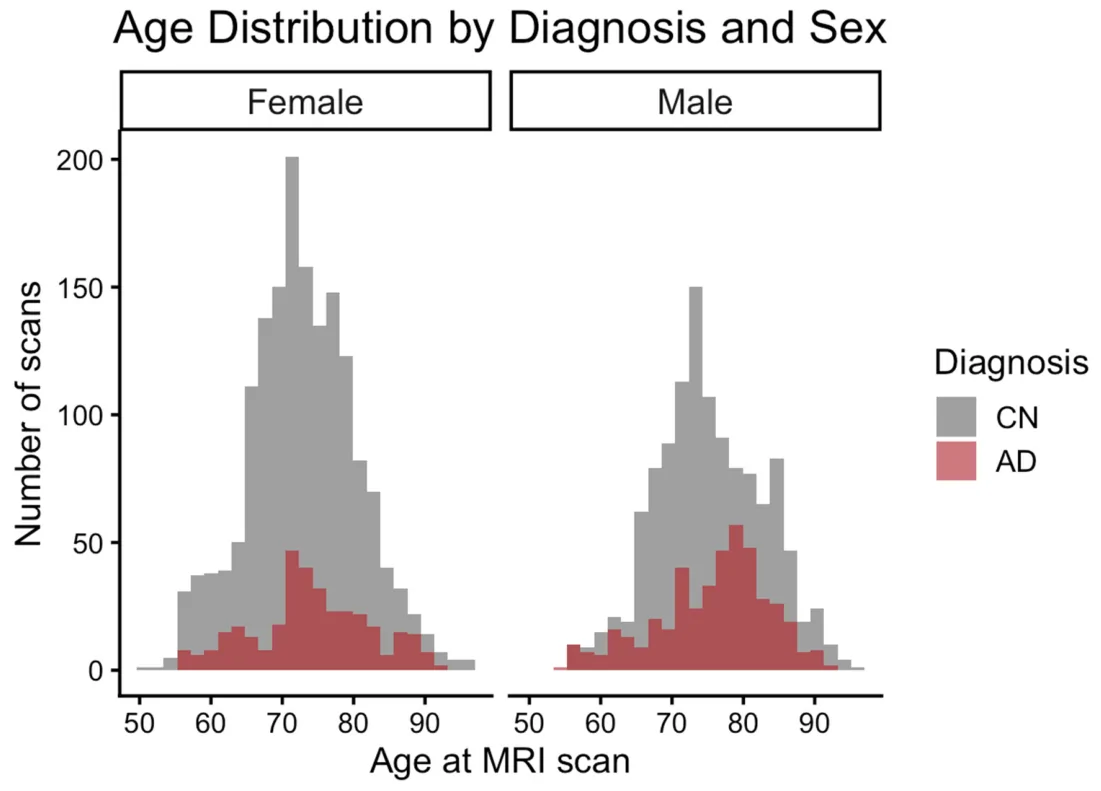 Figure 1. Distribution of age by diagnosis and sex.