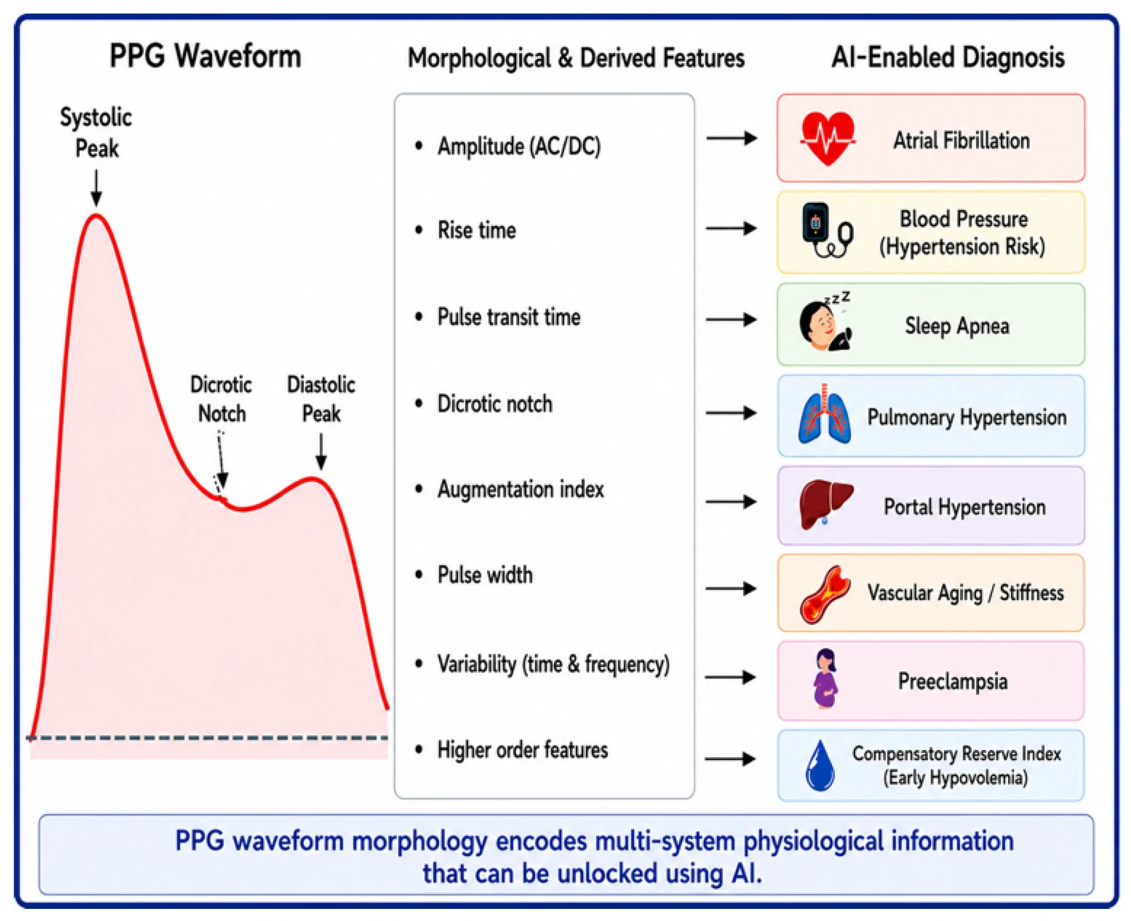 Figure 1. Representative PPG waveform showing the systolic and diastolic components and key morphological features used in PPG analysis.