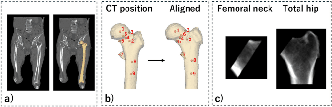 Figure 1 from Journal of Bone and Mineral Metabolism