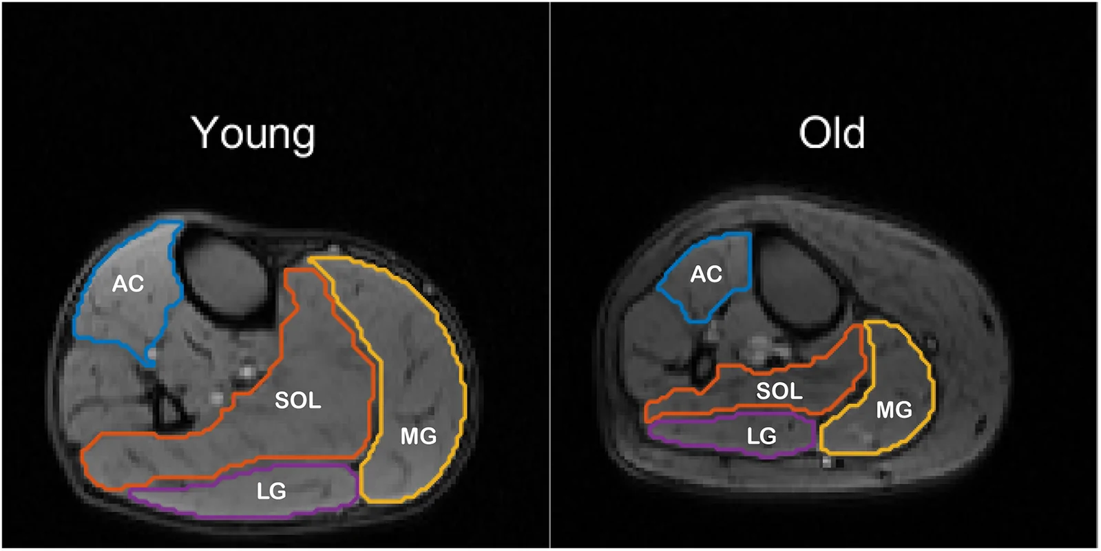Figure 1. Representative muscle boundaries for single MRI slices from one younger (left) and one older (right) participant.