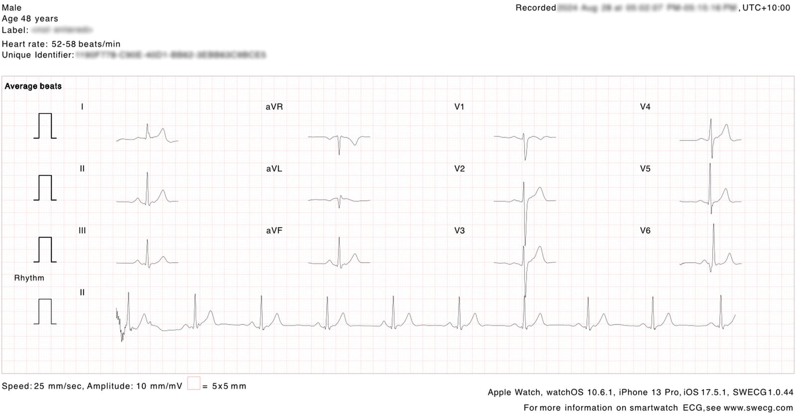 Figure 1 from American Heart Journal