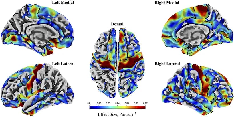 Figure 1. Partial η ² estimates derived from vertex‐wise analyses of cortical thickness associated with WTC‐NESI.