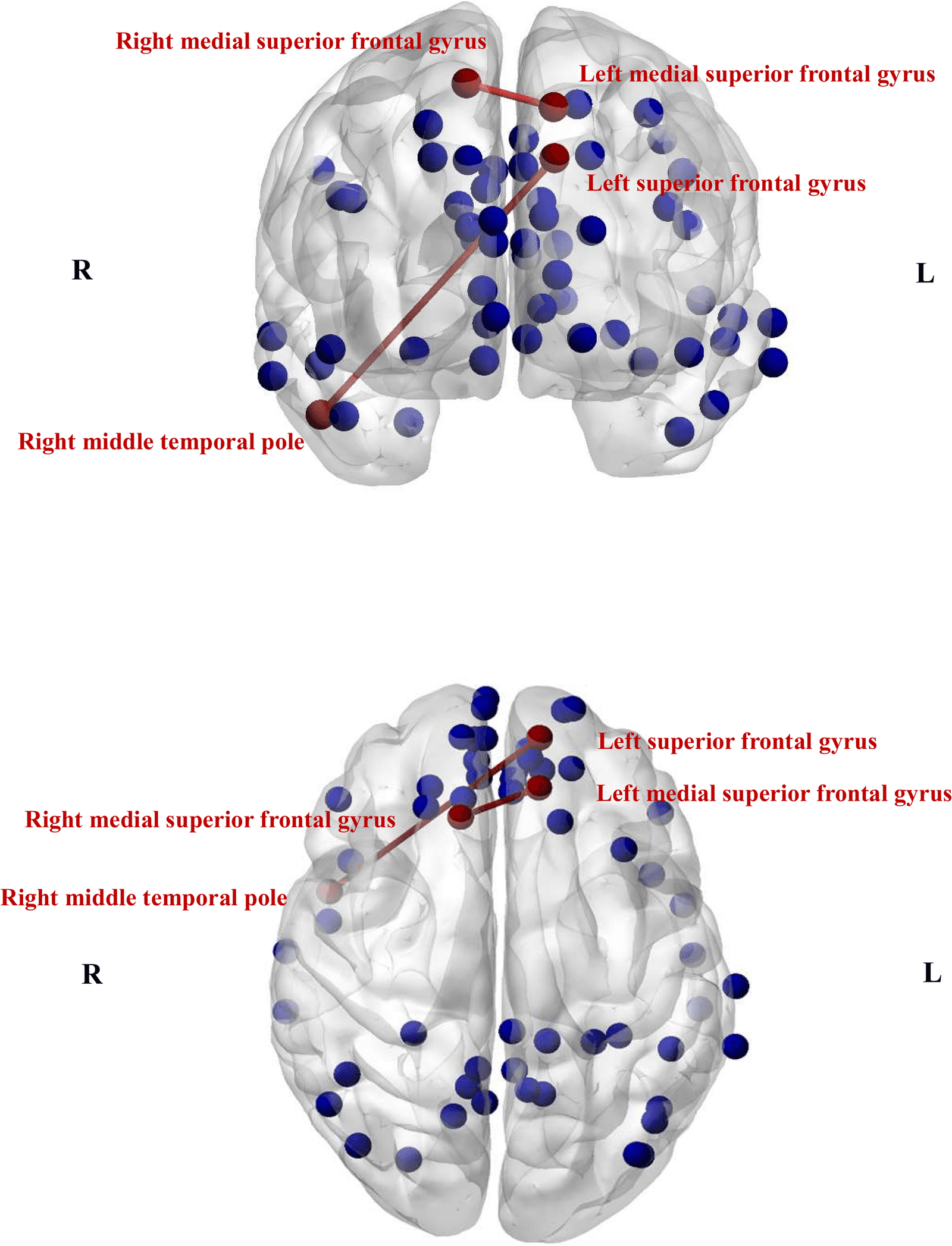Figure 1 from Brain Imaging and Behavior