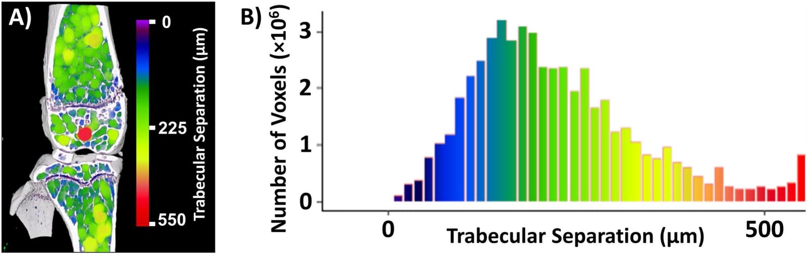 Figure 1 from Bone