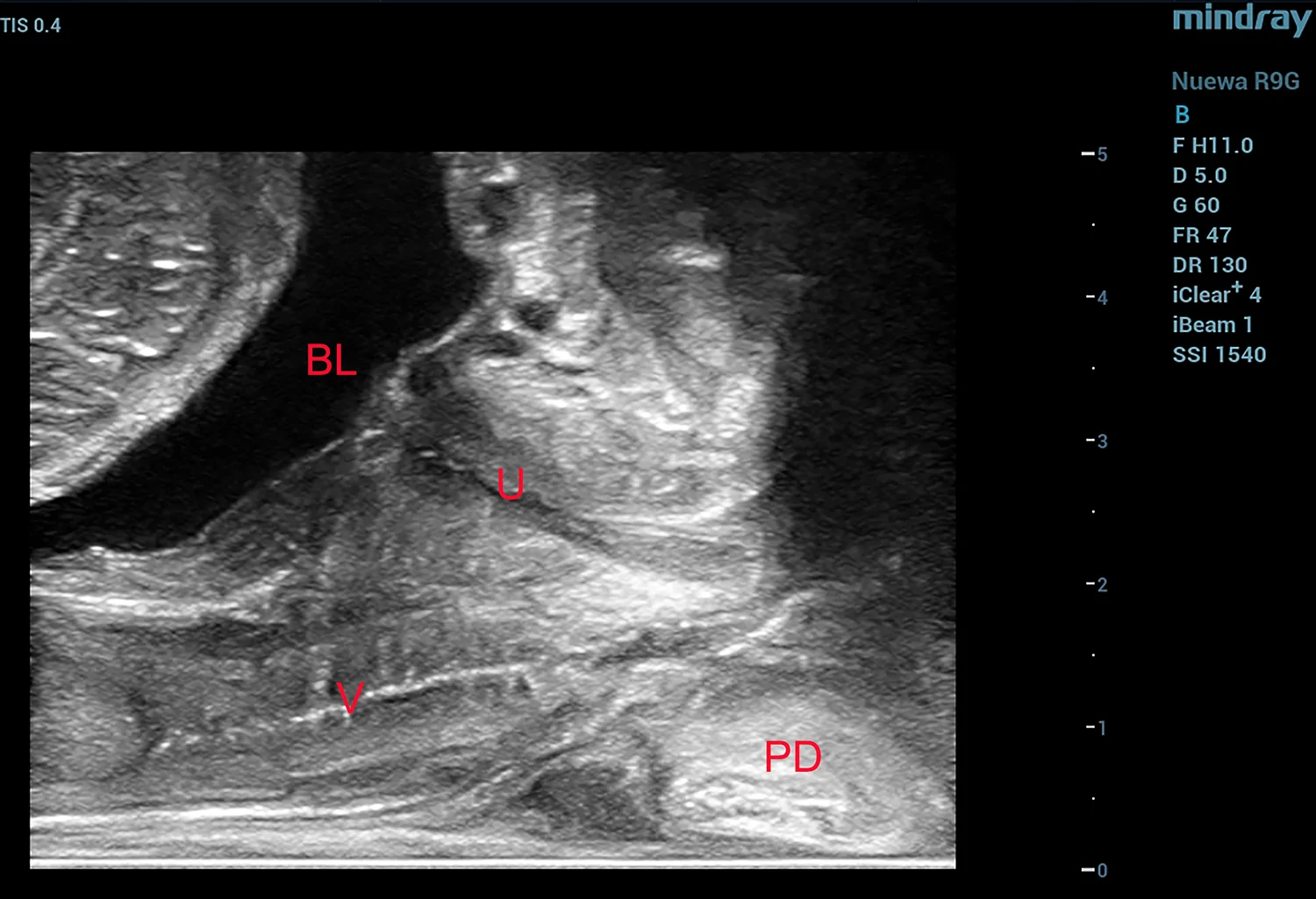 Figure 1. Transrectal B-mode ultrasound visualization of female pelvic anatomy.