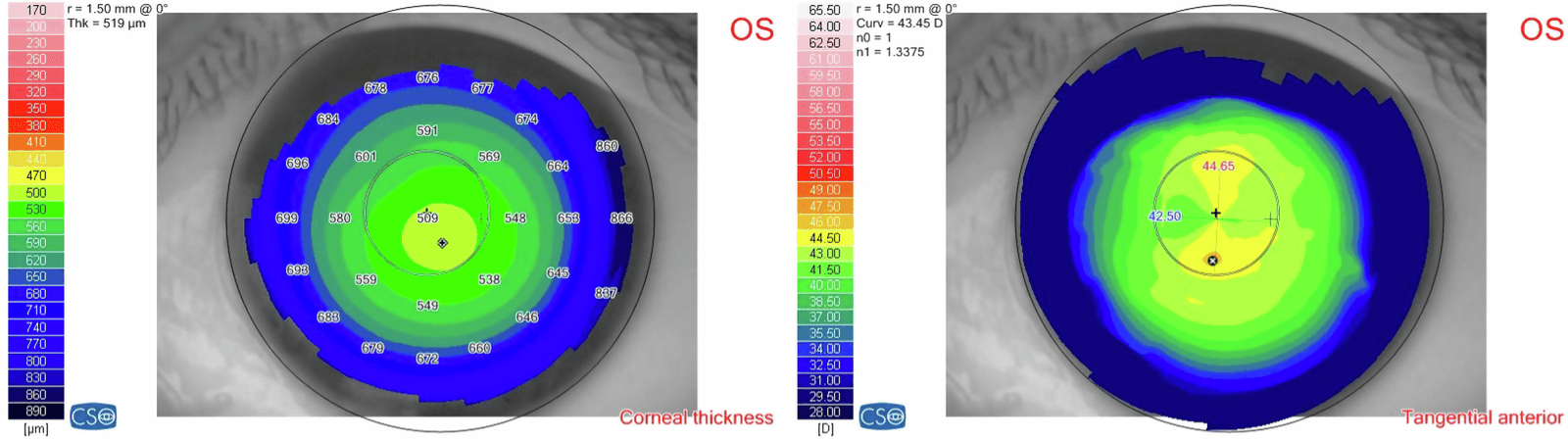 Figure 1 from Ophthalmic & Physiological Optics