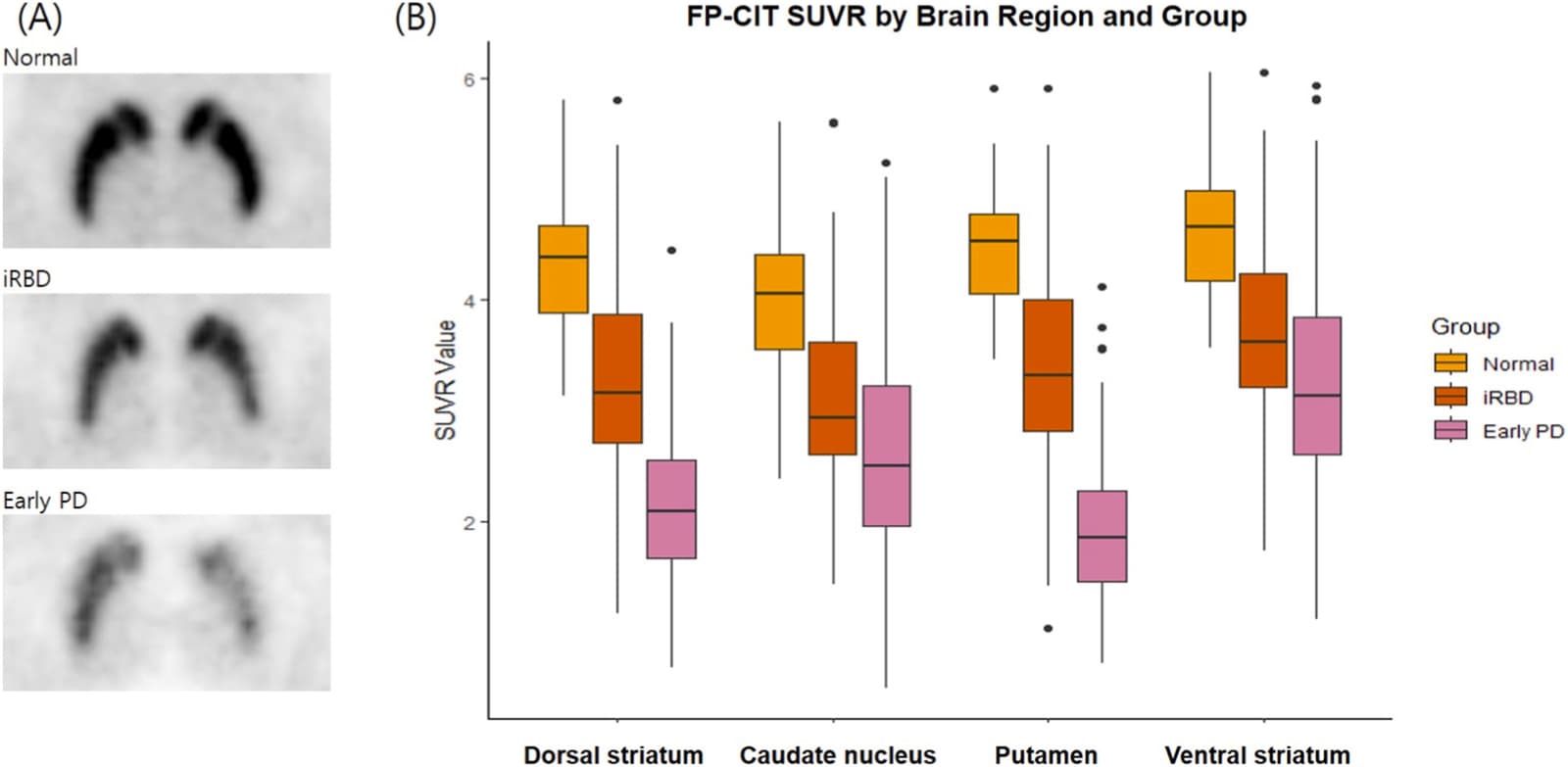 Figure 1 from Sleep Medicine