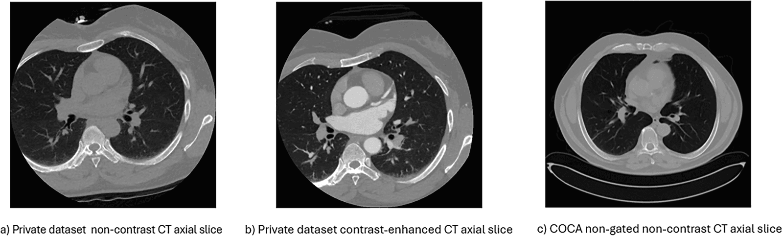 Figure 1 from Journal of Imaging Informatics in Medicine