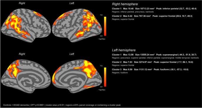 Figure 1 from Journal of Neurology