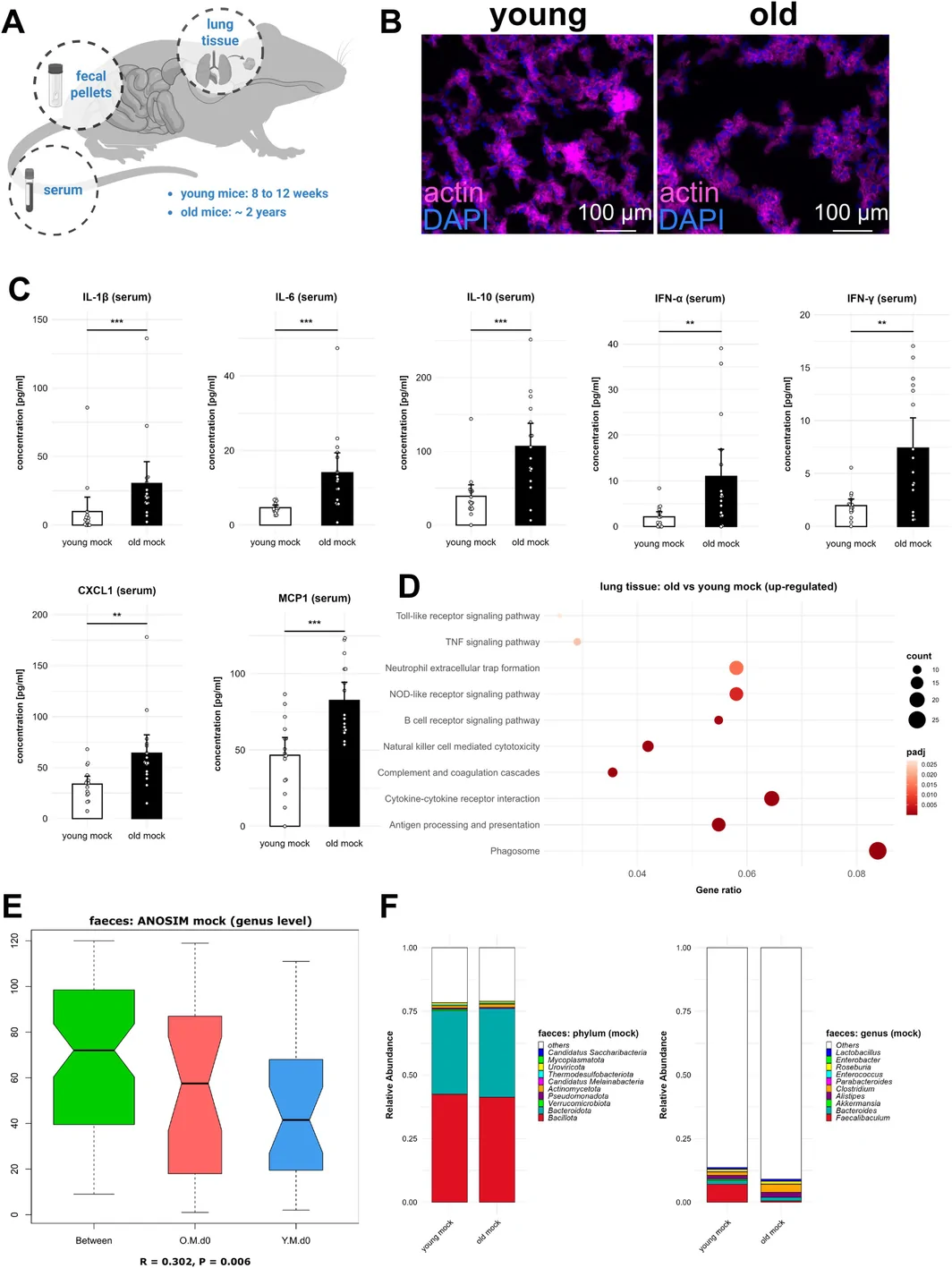 Figure 1. Aging is associated with changes in lung structure, chronic systemic inflammation and dysbiosis in old female C57Bl/6 mice compared to young specimens.