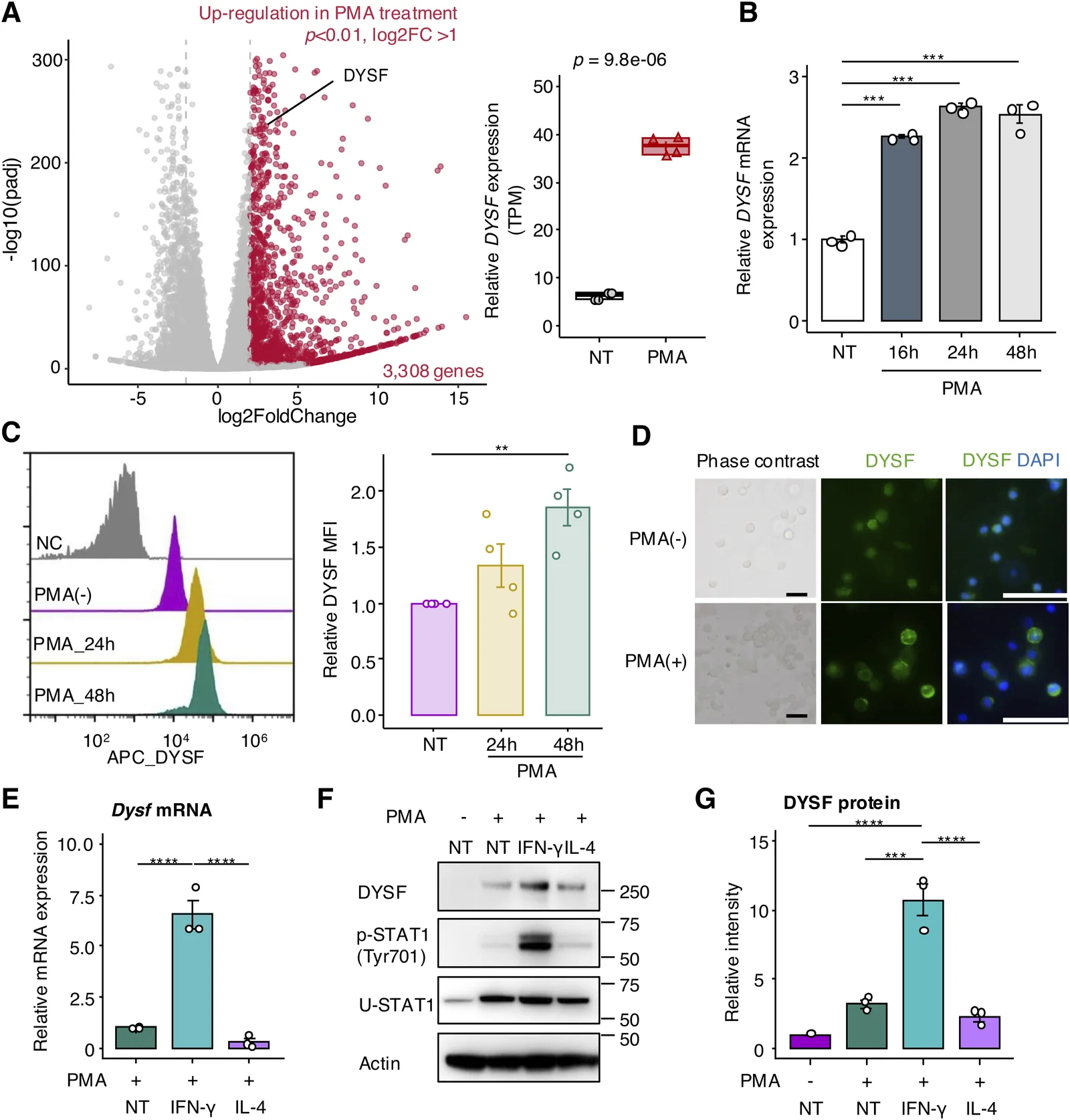 Figure 1. DYSF is up-regulated during monocyte-to-macrophage differentiation.