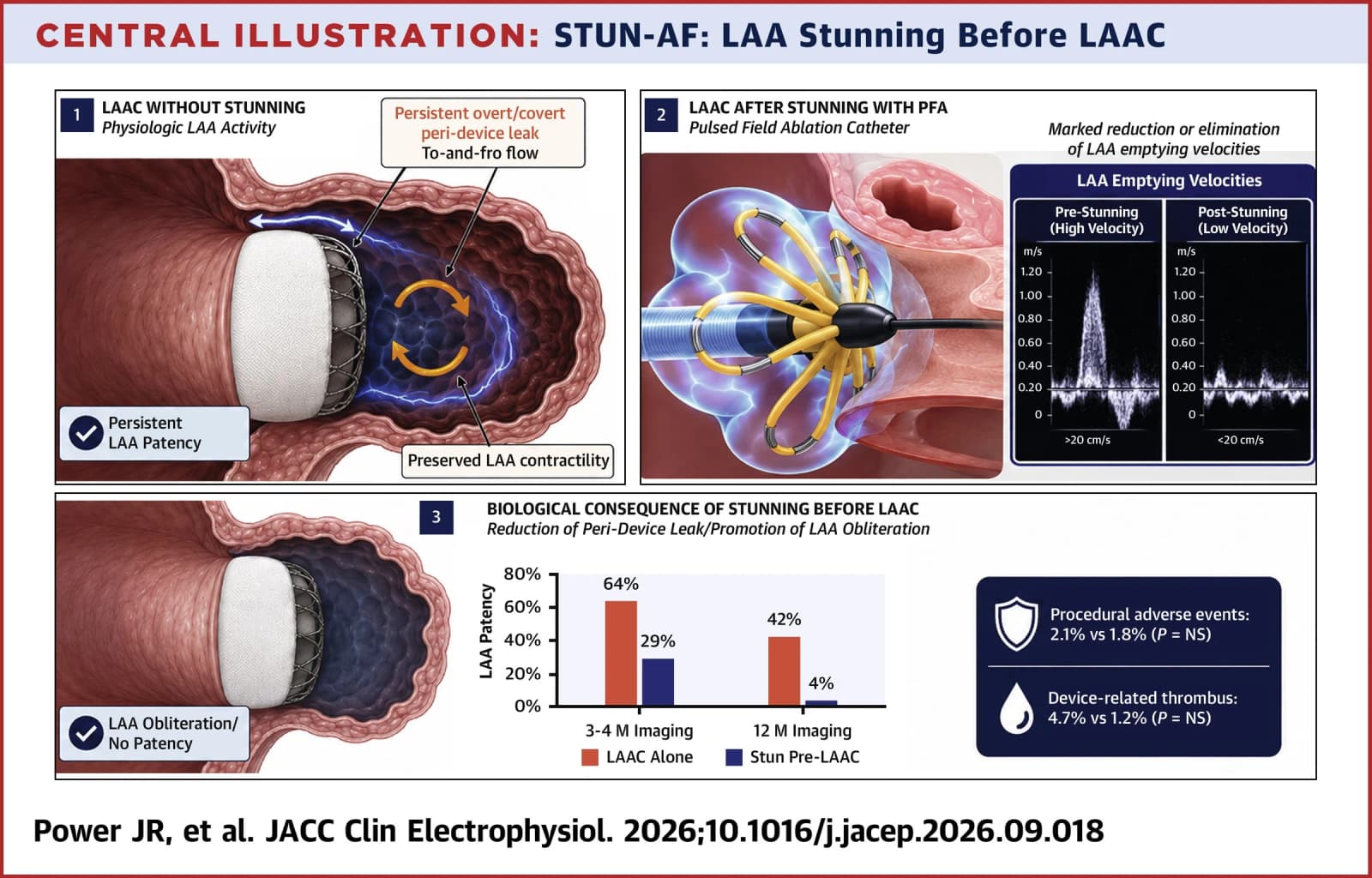 Graphical abstract from JACC Advances
