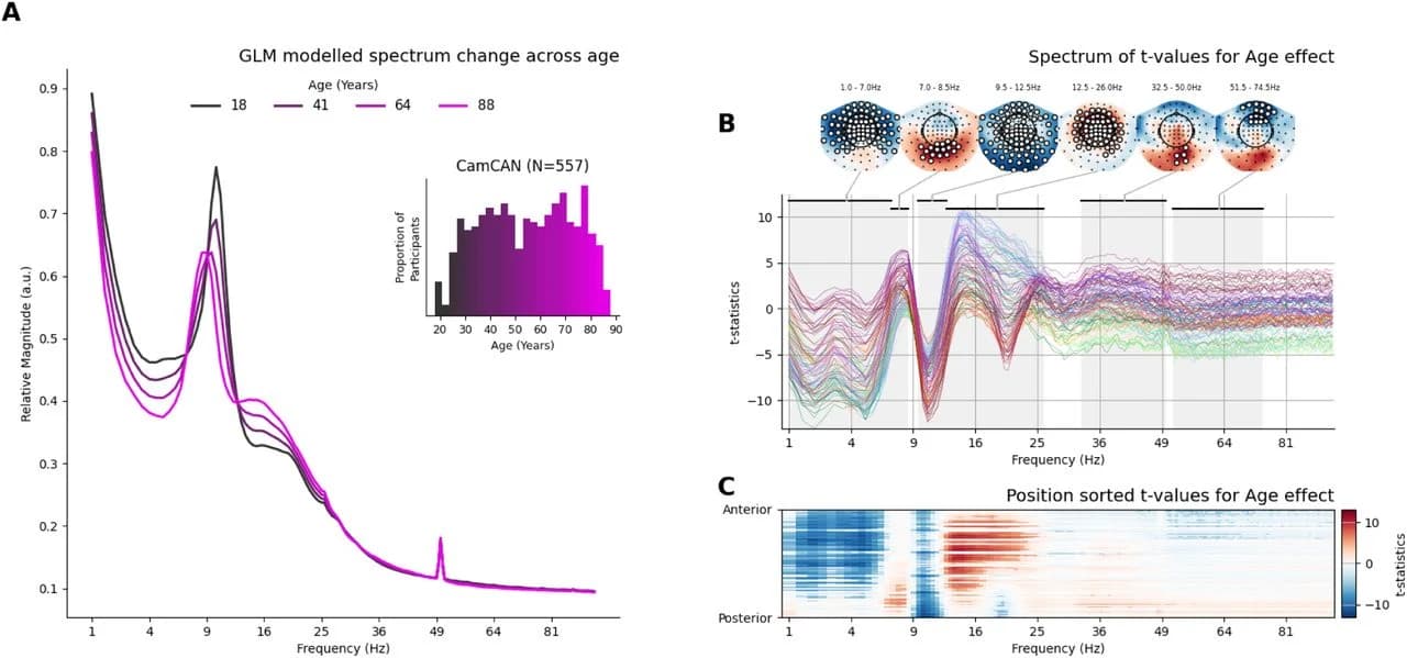 Figure 1 (preprint). Effect of age on the relative magnitude spectrum across space and frequency.