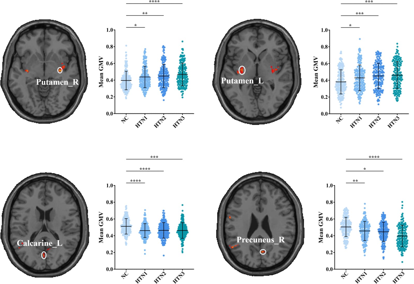 Figure 1 from Brain Imaging and Behavior