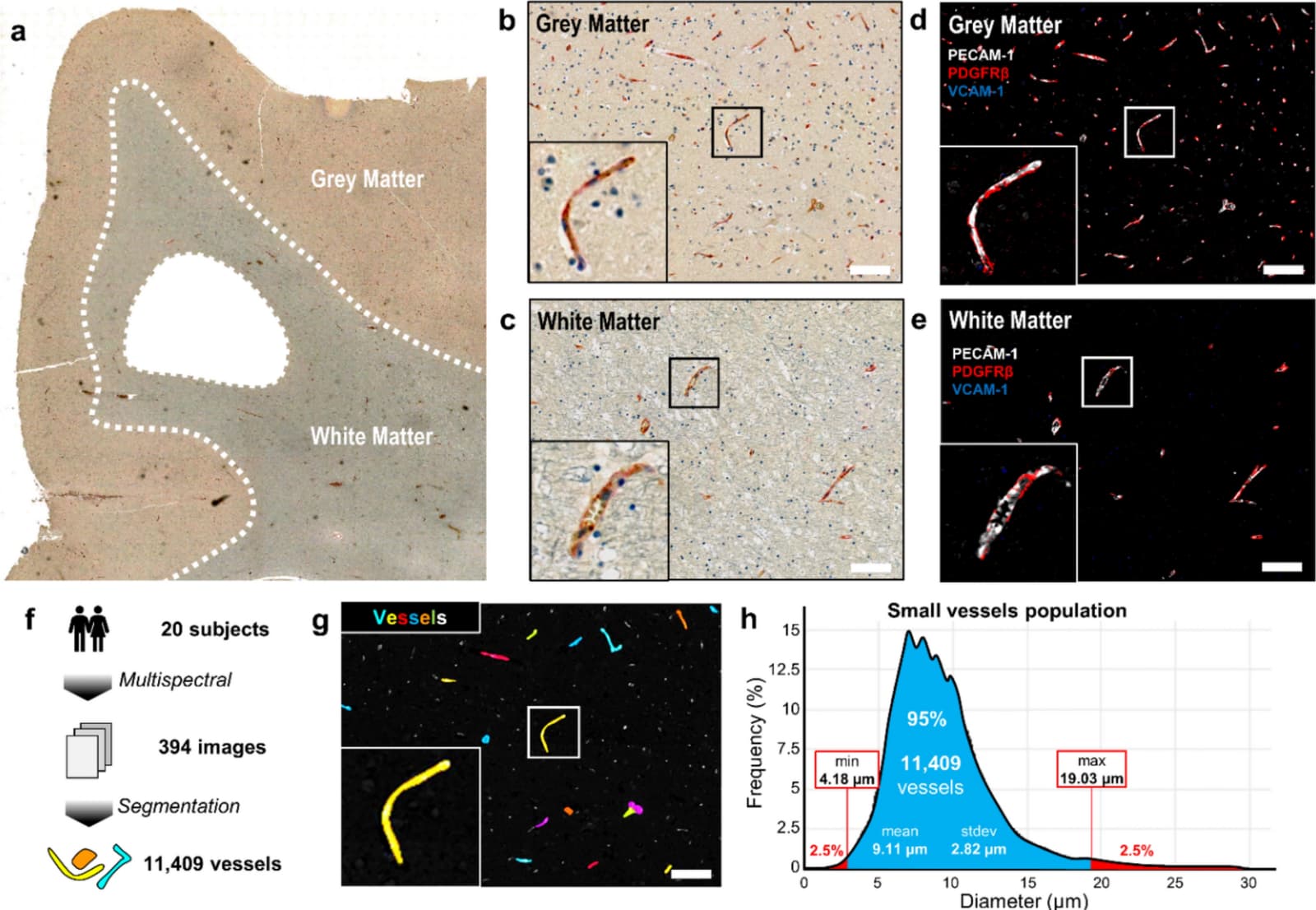 Figure 1 from Acta Neuropathologica
