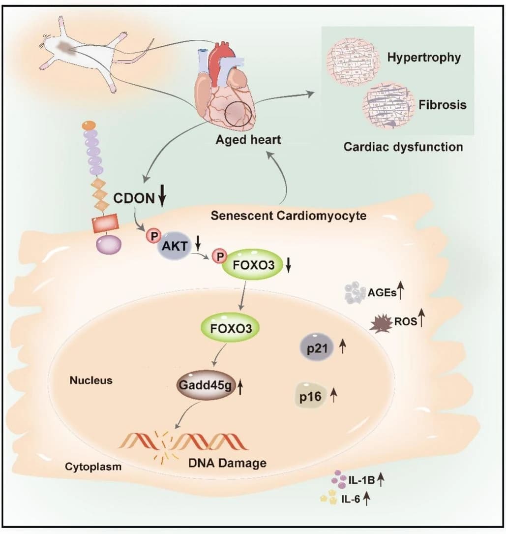 Graphical abstract from Biochimica et Biophysica Acta Molecular Basis of Disease