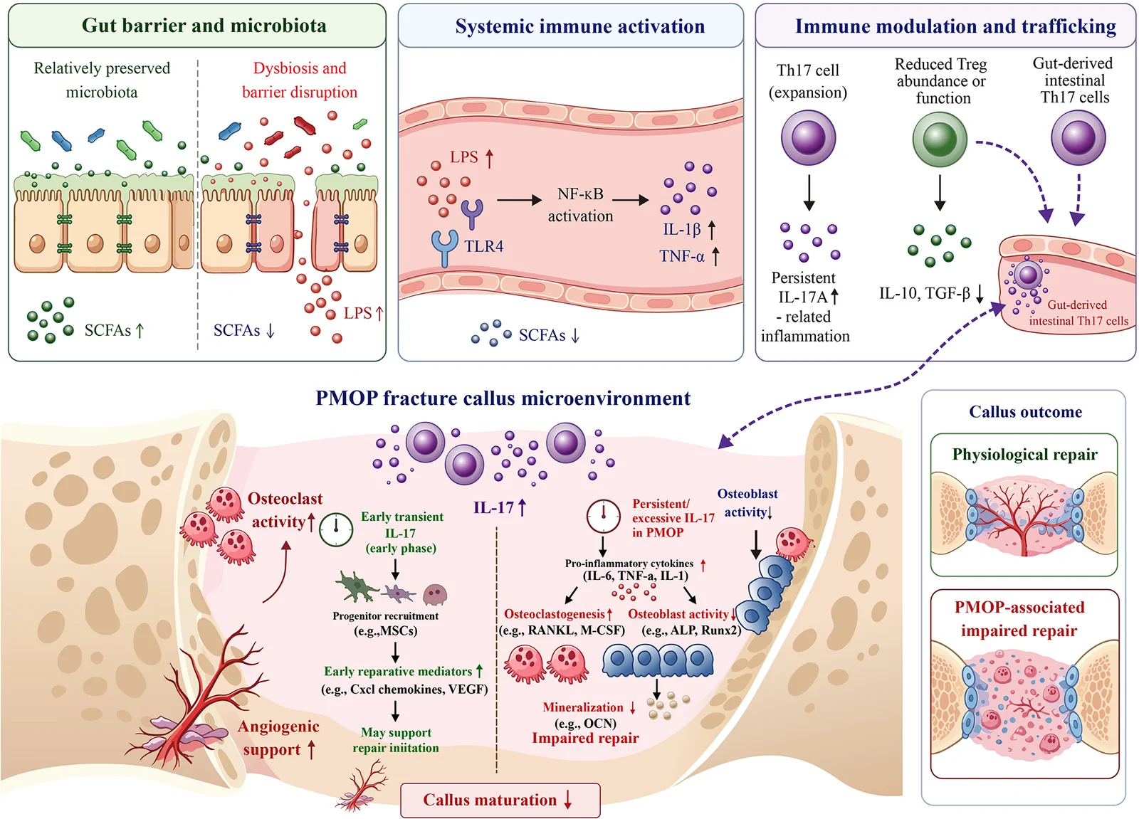Figure 1. Proposed mechanism linking gut dysbiosis to impaired fracture repair in postmenopausal osteoporosis.