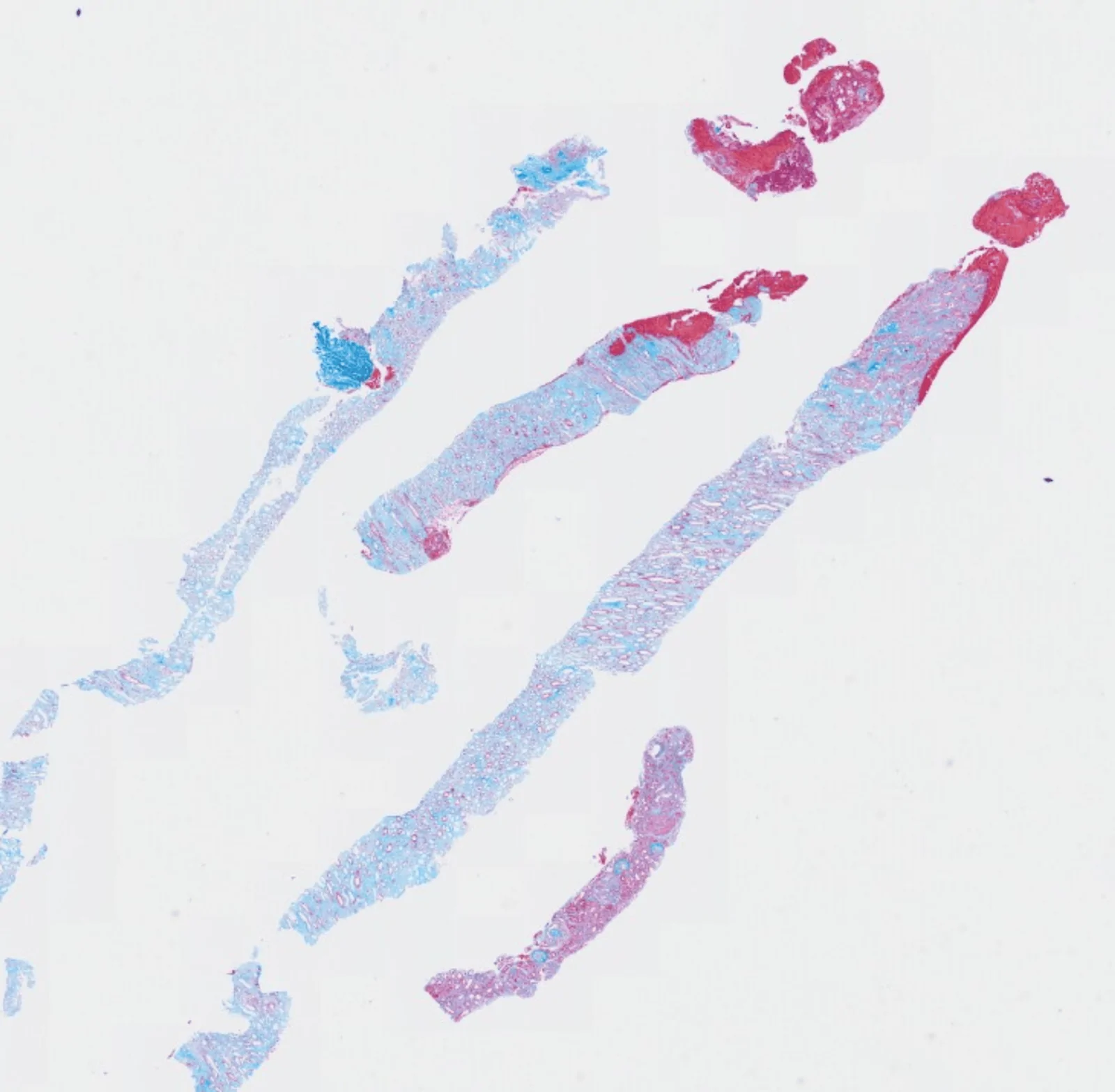 Figure 1. Low-power magnification of the renal biopsy core.