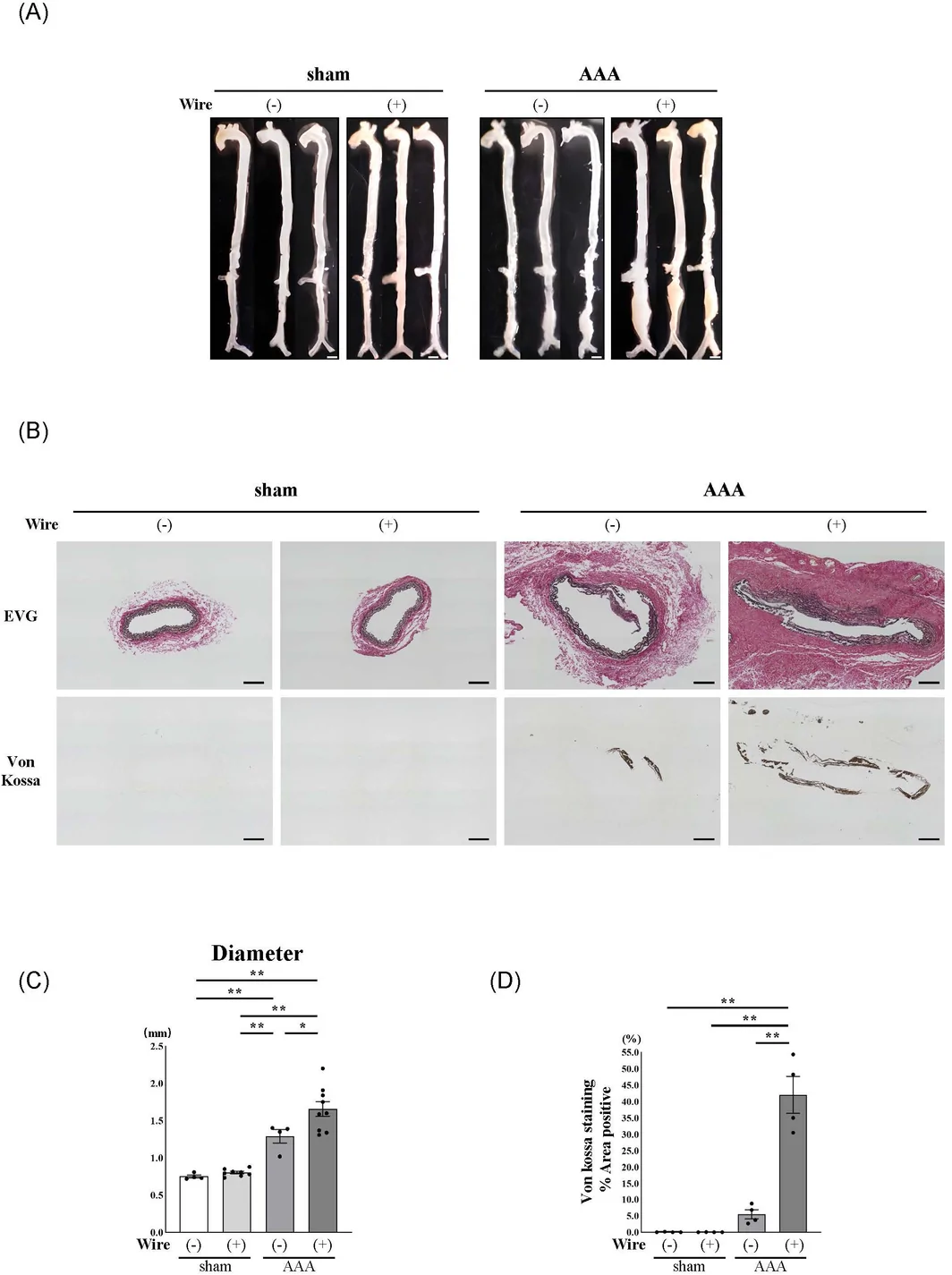 Figure 1. Immobilization accelerates vascular calcification and AAA formation.