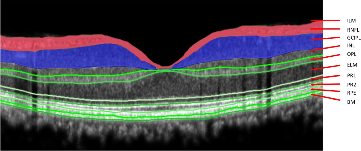 Figure 1 from Journal of Neurology