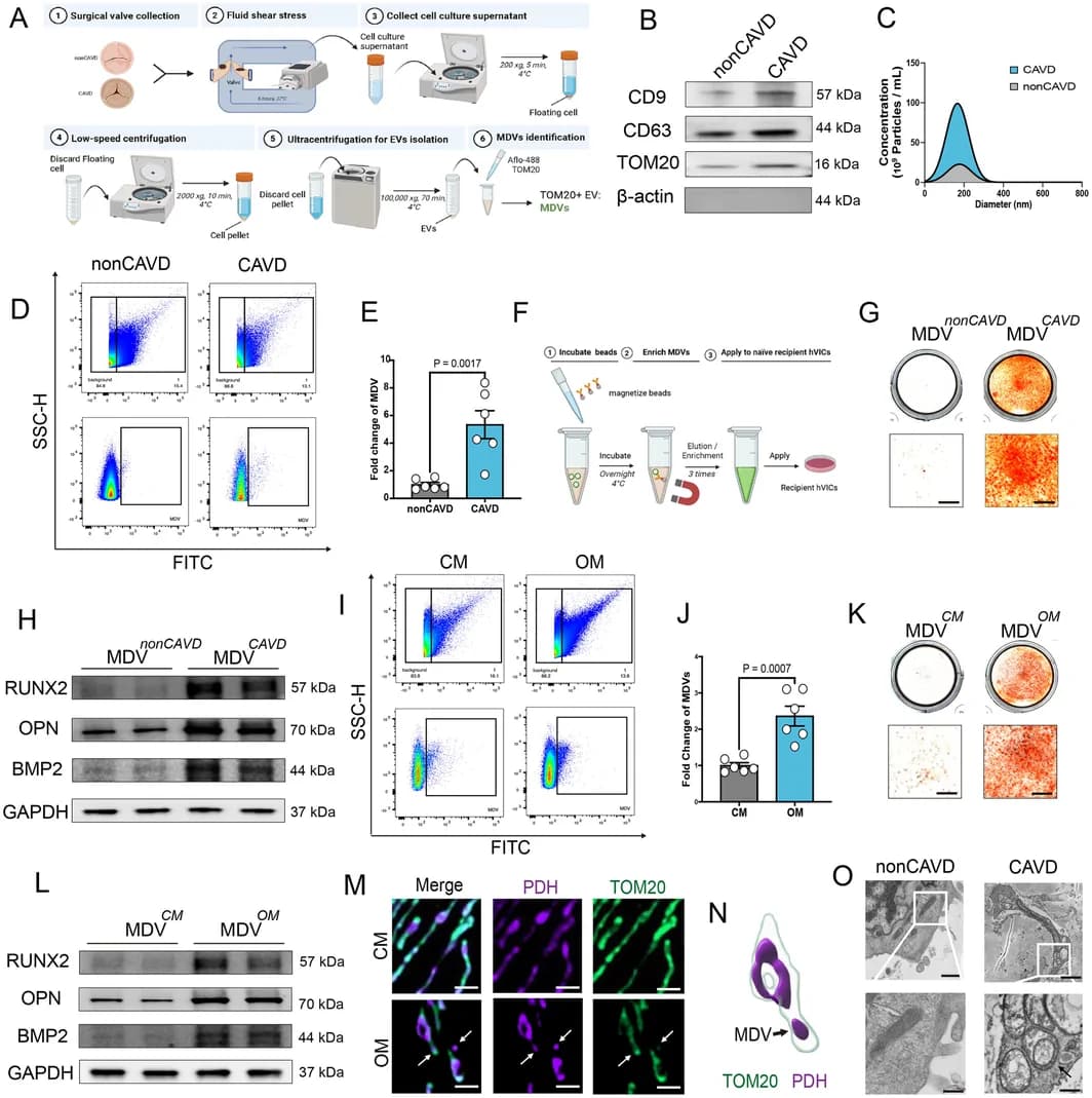 Figure 1. Mitochondrial‐derived vesicles act as pro‐calcific mediators in valvular calcification.