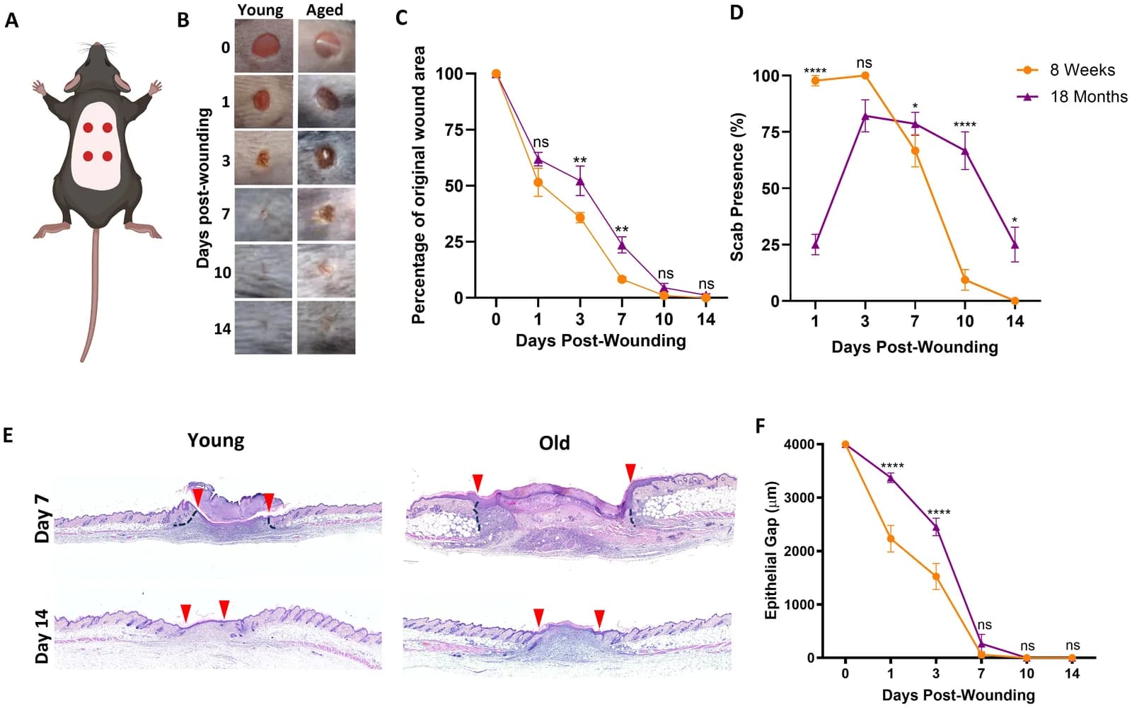 Aged skin exhibits delays throughout wound healing (A) Macroscopic showing the placement of four 4 mm excisional wounds made to the dorsal skin of young (8 week) and old (18 month) C57Bl/6JCR mice.