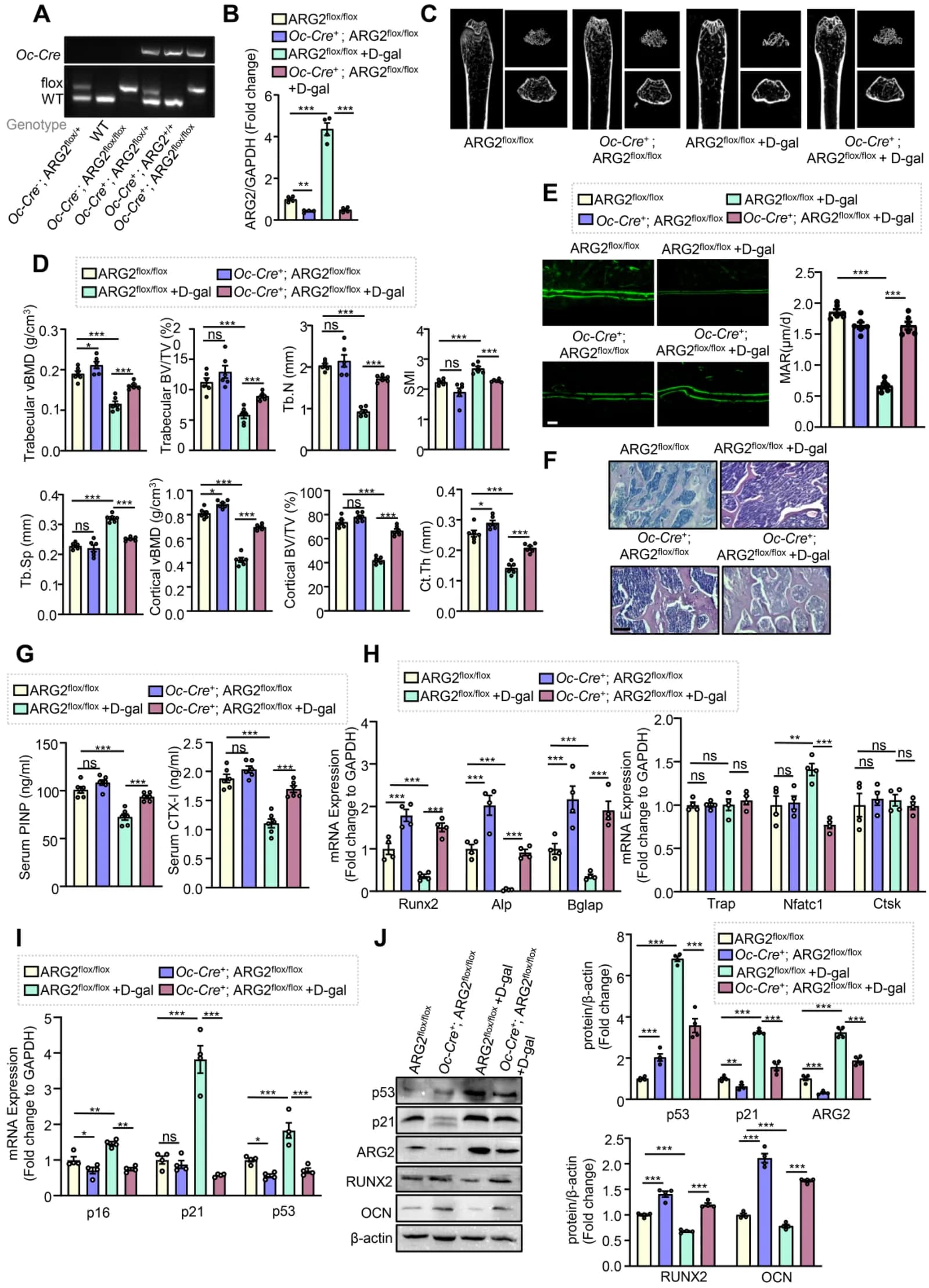 Osteoblast-specific knockdown of ARG2 alleviates age-related osteoporosis.