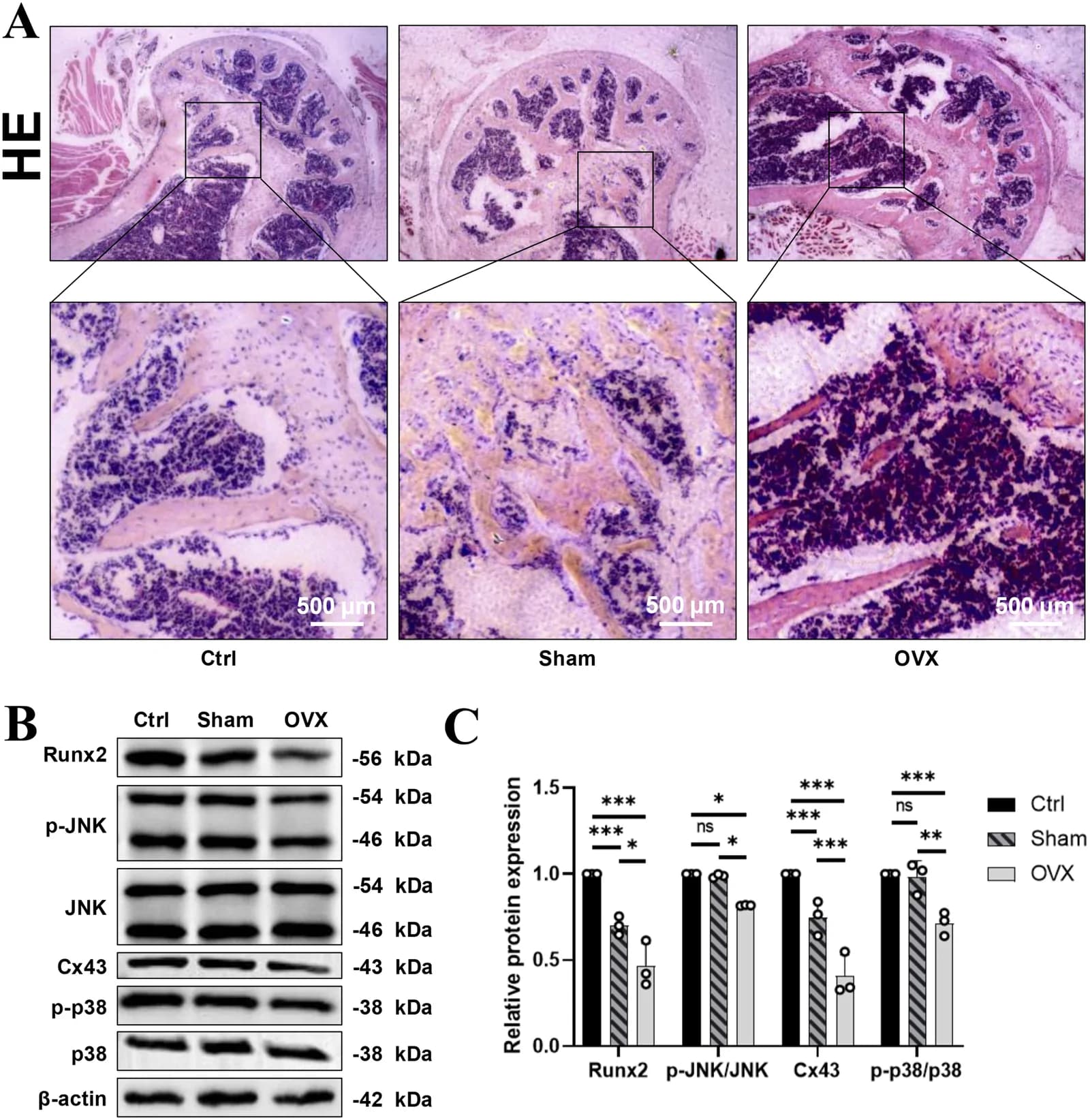 OVX surgery deteriorates bone histology and suppresses Cx43-p38/JNK-Runx2 signaling in mouse bone tissue.