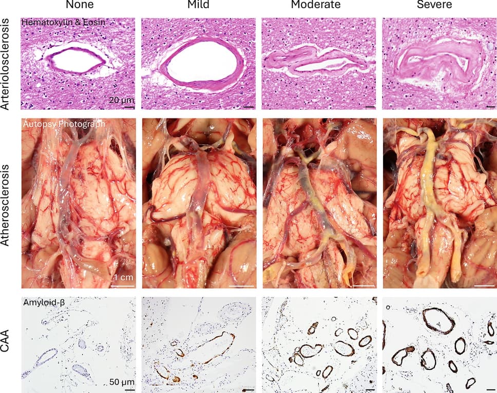 Figure 1 from Acta Neuropathologica
