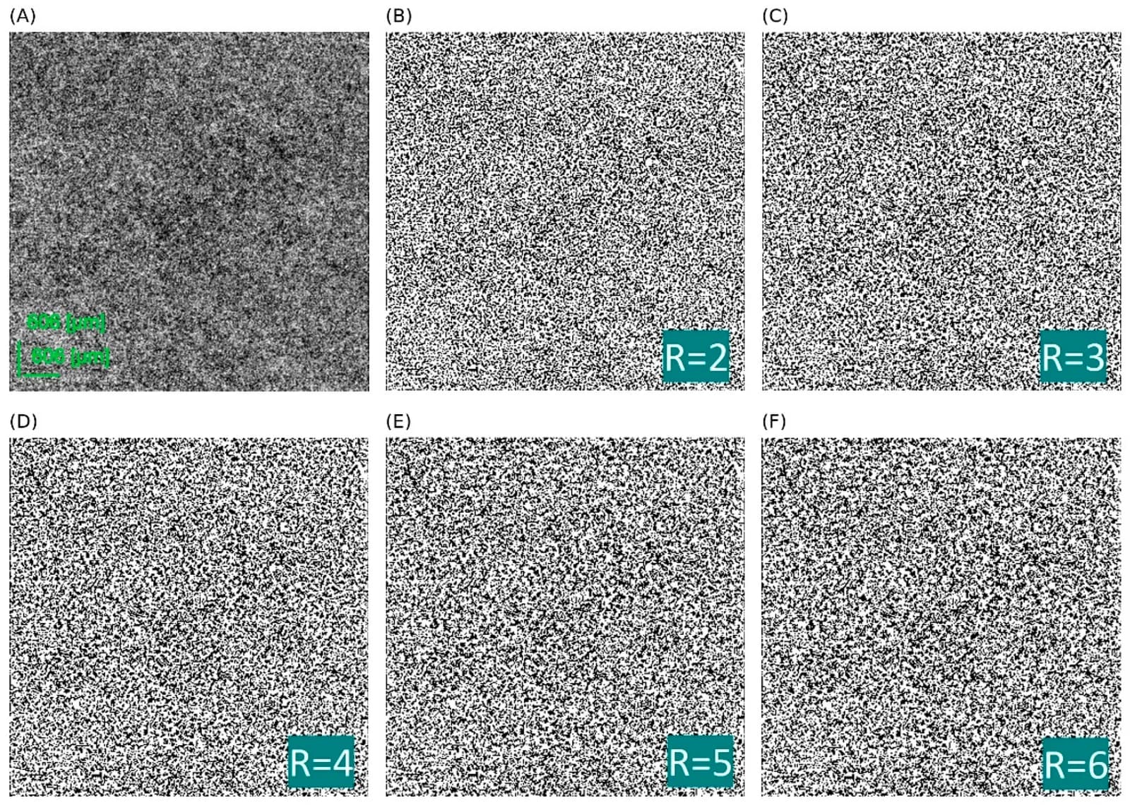 Choriocapillaris OCTA image and Phansalkar binarization at different window radii.