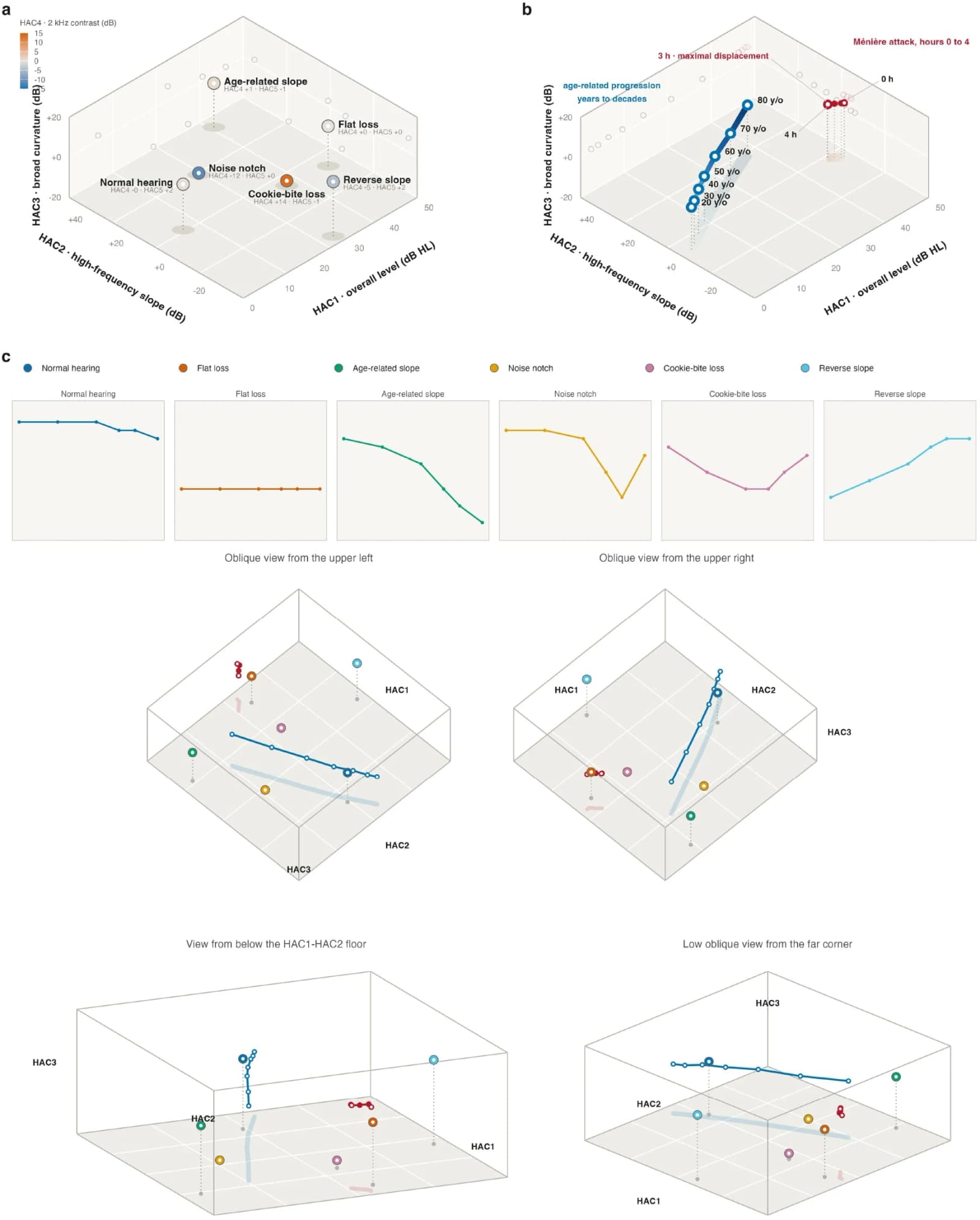 Figure 1. | The Atlas coordinate space of human hearing.(a) Six illustrative audiometric configurations projected with the frozen basis into the first three Atlas coordinates: position encodes HAC1 (overall…