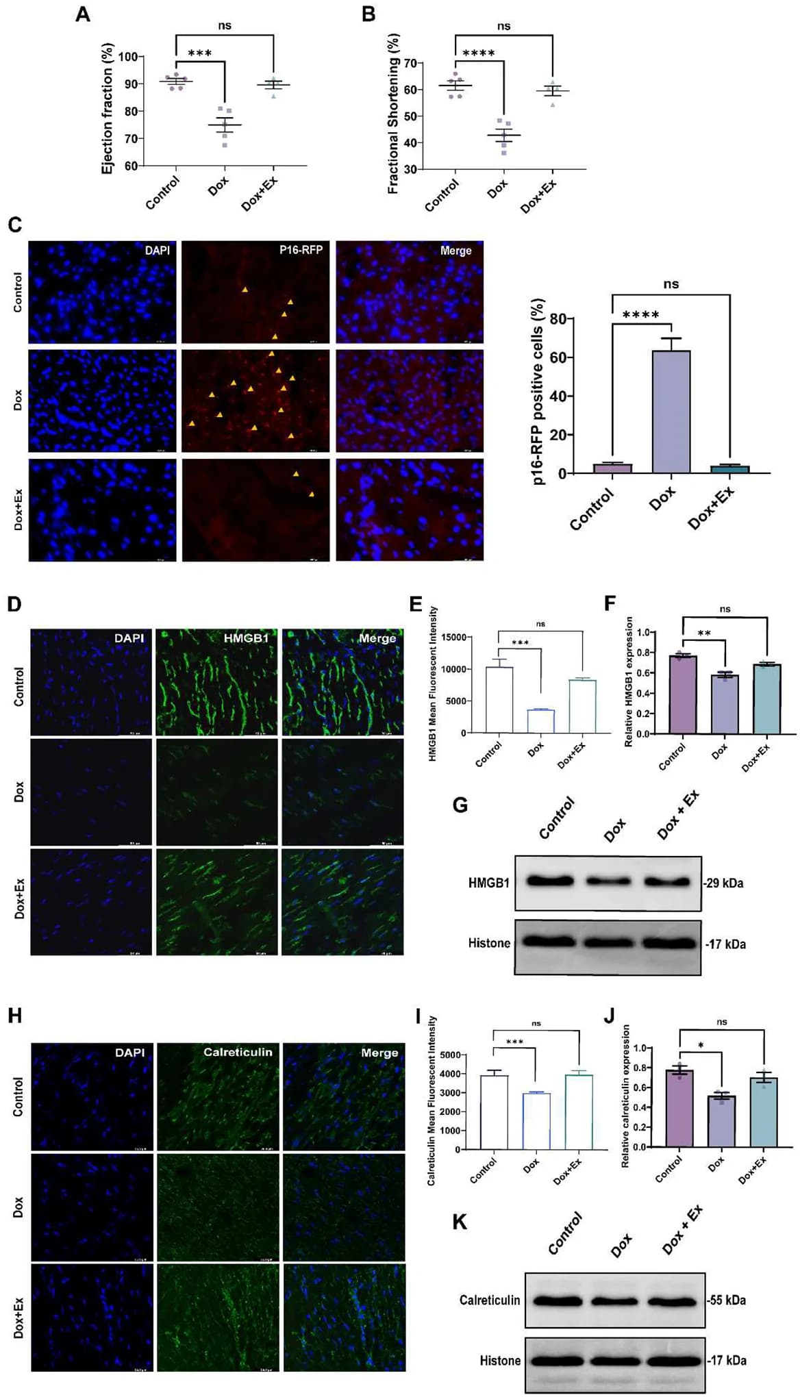 Exercise inhibits Dox-induced cardiac senescence and functional cardiotoxicity.