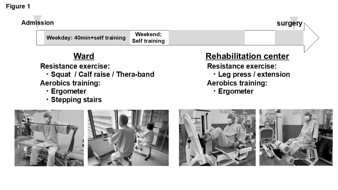 Figure 1. Preoperative rehabilitation in our department.