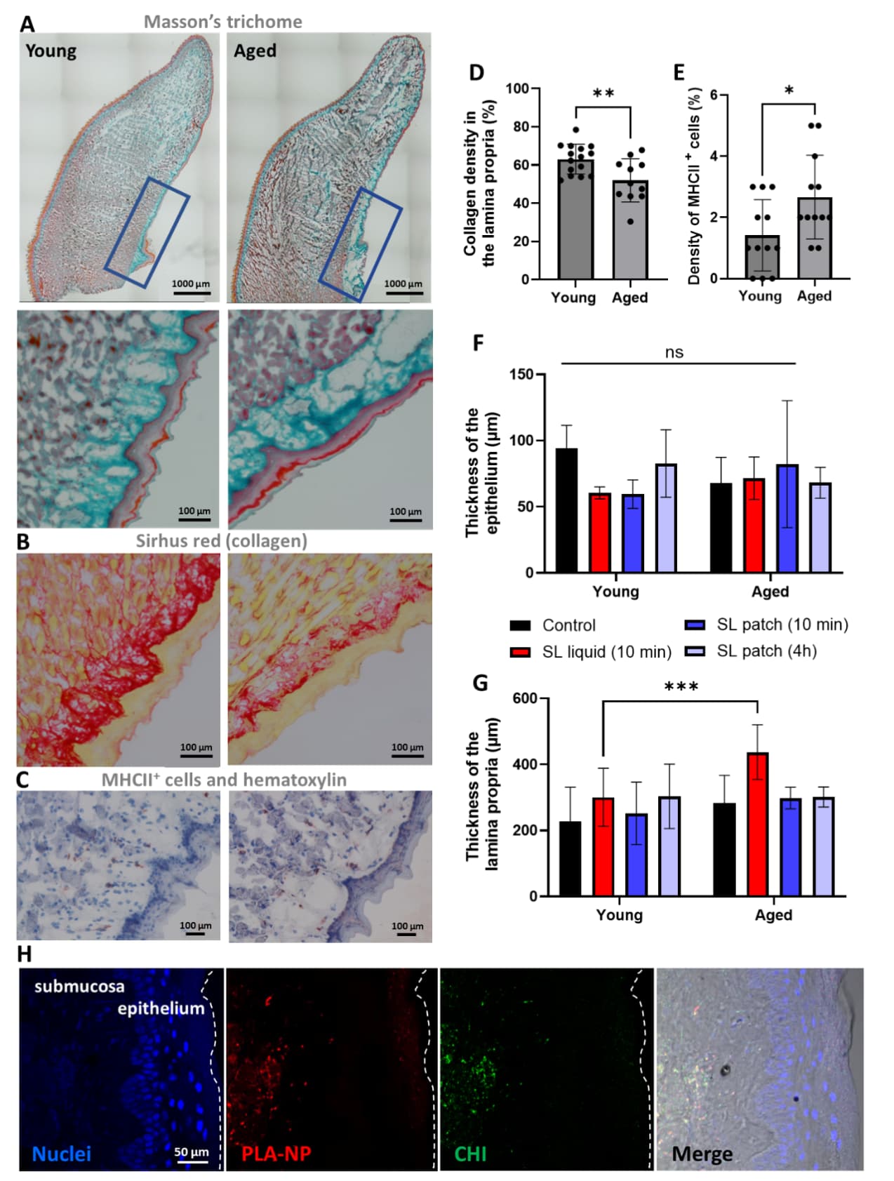 Figure 1. Histological analysis of the suglingual tissue ageing.