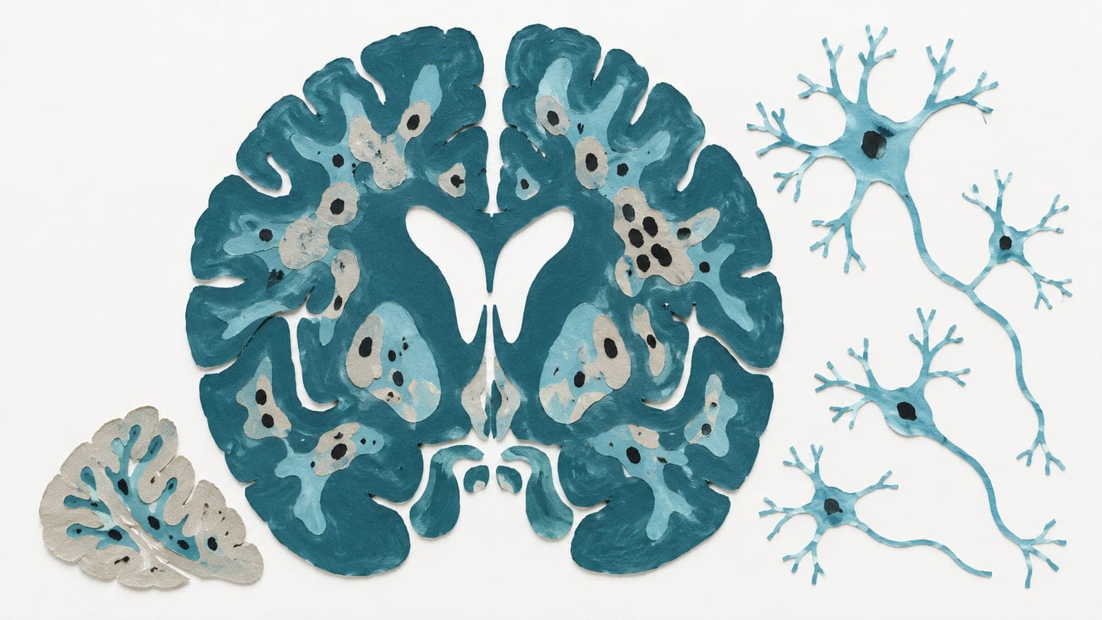 A brain cross-section with many dark cell markings sits beside a smaller grey tissue fragment with fewer markings and branching neurons.