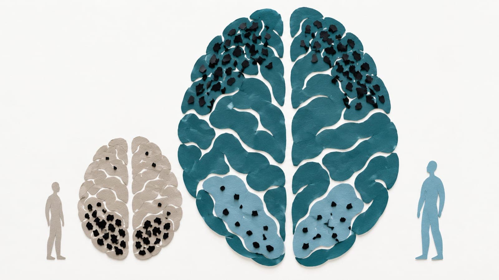 Brains beside small upright figures show sparse rear and dense front patterns in dark blue-green, with the reverse in the smaller gray brain.