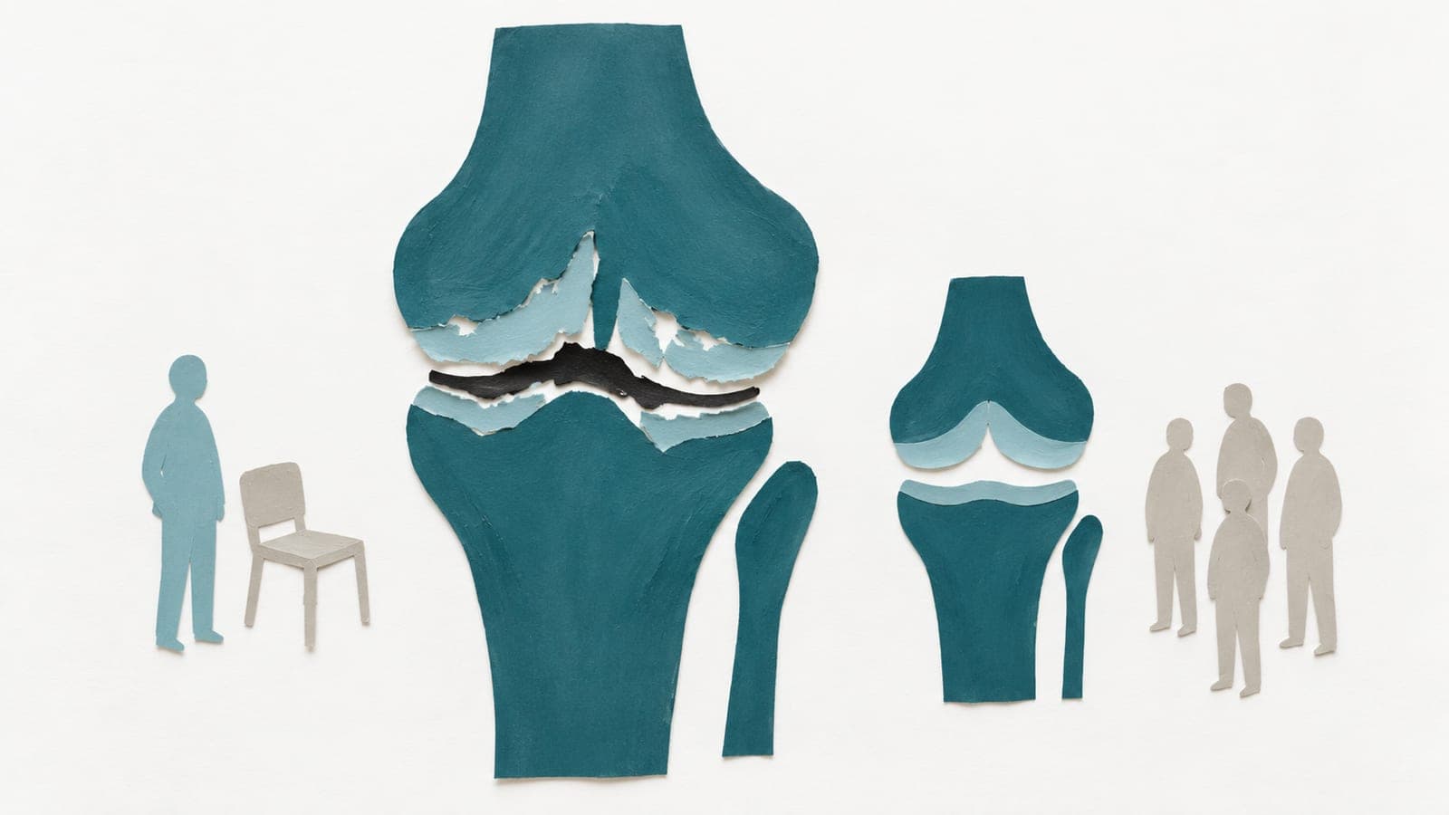 A worn knee joint with ragged cartilage sits near a lone figure and chair; a smaller, smooth joint stands beside a group of upright figures.