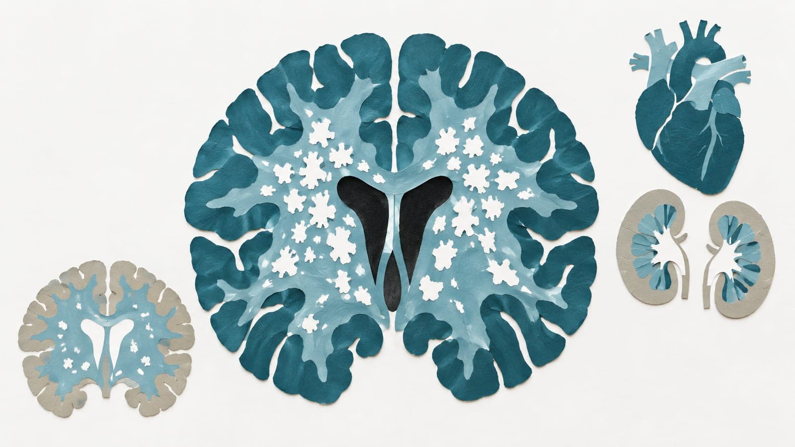 Brain cross-sections show dense white patches in a large dark blue-green brain and sparse patches in a smaller gray brain, beside a heart and kidneys.